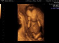 scan.jpg