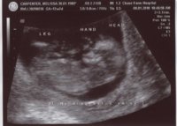 Ultrasound12weeks.jpg