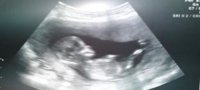 1st baby scan pic 13 weeks1.jpg