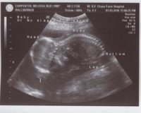 20weekultrasound.jpg