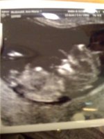 scan12weeks.jpg