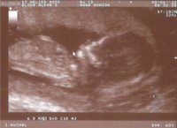baby1.jpg baby1.jpg