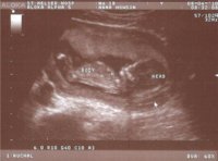 baby2.jpg baby2.jpg