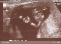 baby thumbs up.jpg baby thumbs up.jpg