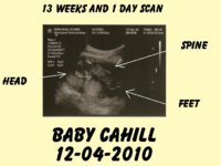 SCAN DETAILED.JPG