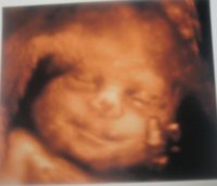 babys 4d 229.jpg