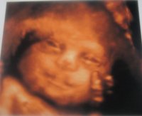 babys 4d 232.jpg