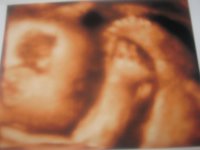 babys 4d 234.jpg