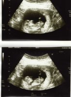 Baby Noonan 12 weeks.jpg