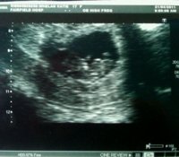 First Picture Of You.jpg
