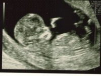 Babyscan2.jpg