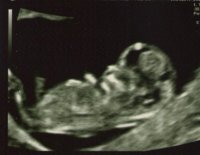 Babyscan5.jpg