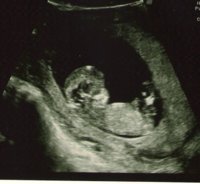 Babyscan6.jpeg