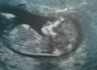 Scan pic 12w4d.jpg