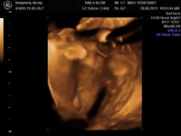 BABY KIRSTY_120.JPG