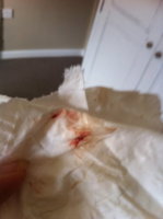 TMI is this implantation bleeding?