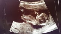 12 Week Scan.jpg