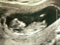 baby.jpg