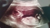 13 weeks scan pic.JPG