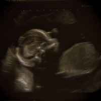Babeh20wkScanResize.jpg