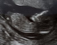 my 12 week.jpg