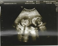 17+3 weeks1 mama dada.jpg