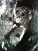 ImageUploadedByTapatalk1307468861.644782.jpg