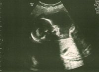20 weeks2 days scan 1.jpg