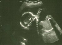 20 weeks 2 days scan 2.jpg