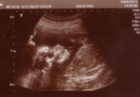 19wks6days.jpg