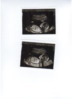 baby crumpet scanned.jpg