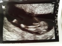 echo 12w 5d.jpg