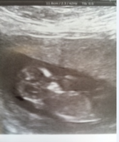 scan1.PNG