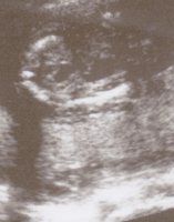 ultrasound.jpg