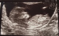 12wk Scan photo.jpg