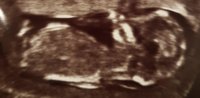 20170705_081642.jpg
