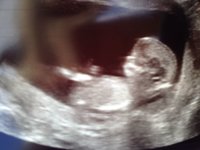 IMG-20170814-WA0001.jpg