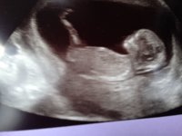 IMG-20170814-WA0002.jpg