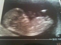 baby.JPG