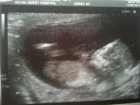 scan at 13 weeks.jpg