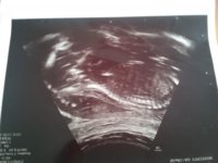 20171017_113751.jpg