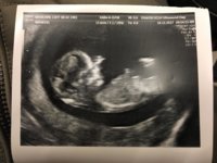 12 week scan pic.jpg