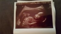 FB_IMG_1517502434729.jpg