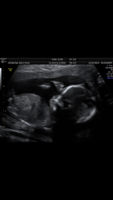 upload_2019-5-22_18-39-8.png