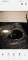 Screenshot_20191021_112525_com.android.gallery3d.jpg