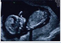 Baby.jpeg