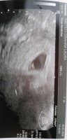 IMG-20200304-WA0011.jpeg