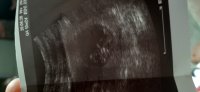 20200904_153534.jpg