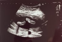 20 week tootsies.jpg