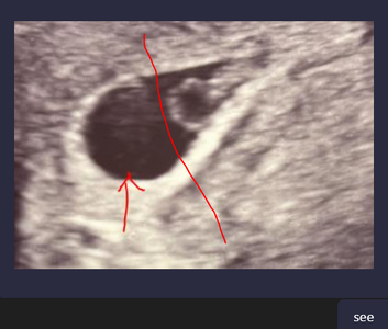 baby1.PNG